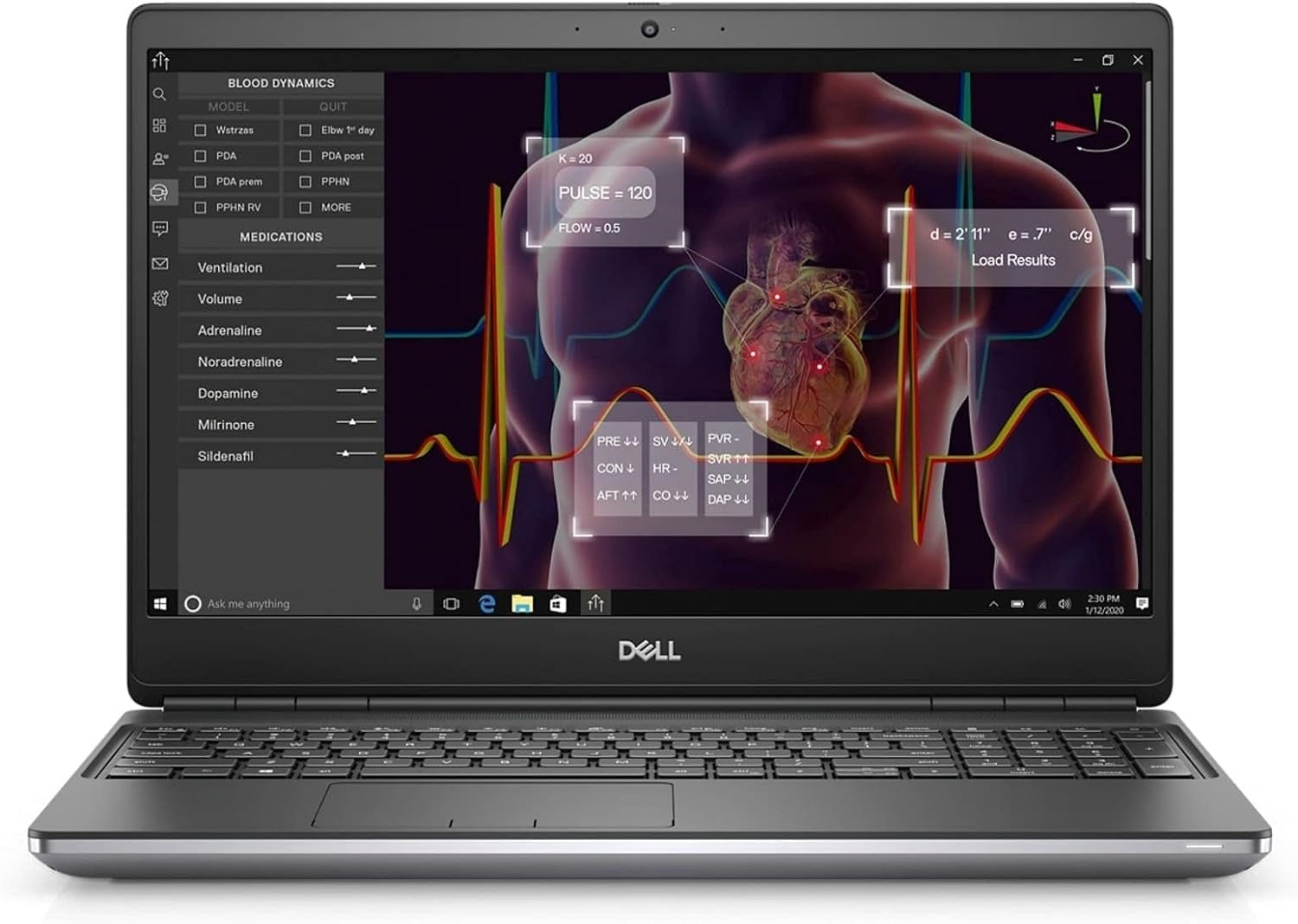 2020 Dell Precision 7550 Laptop 15.6 - Intel Xeon -1TB SSD - 64GB RAM - 6GB 3000 Series Graphics - 1920x1080 FHD - Windows 10 Pro (Renewed)